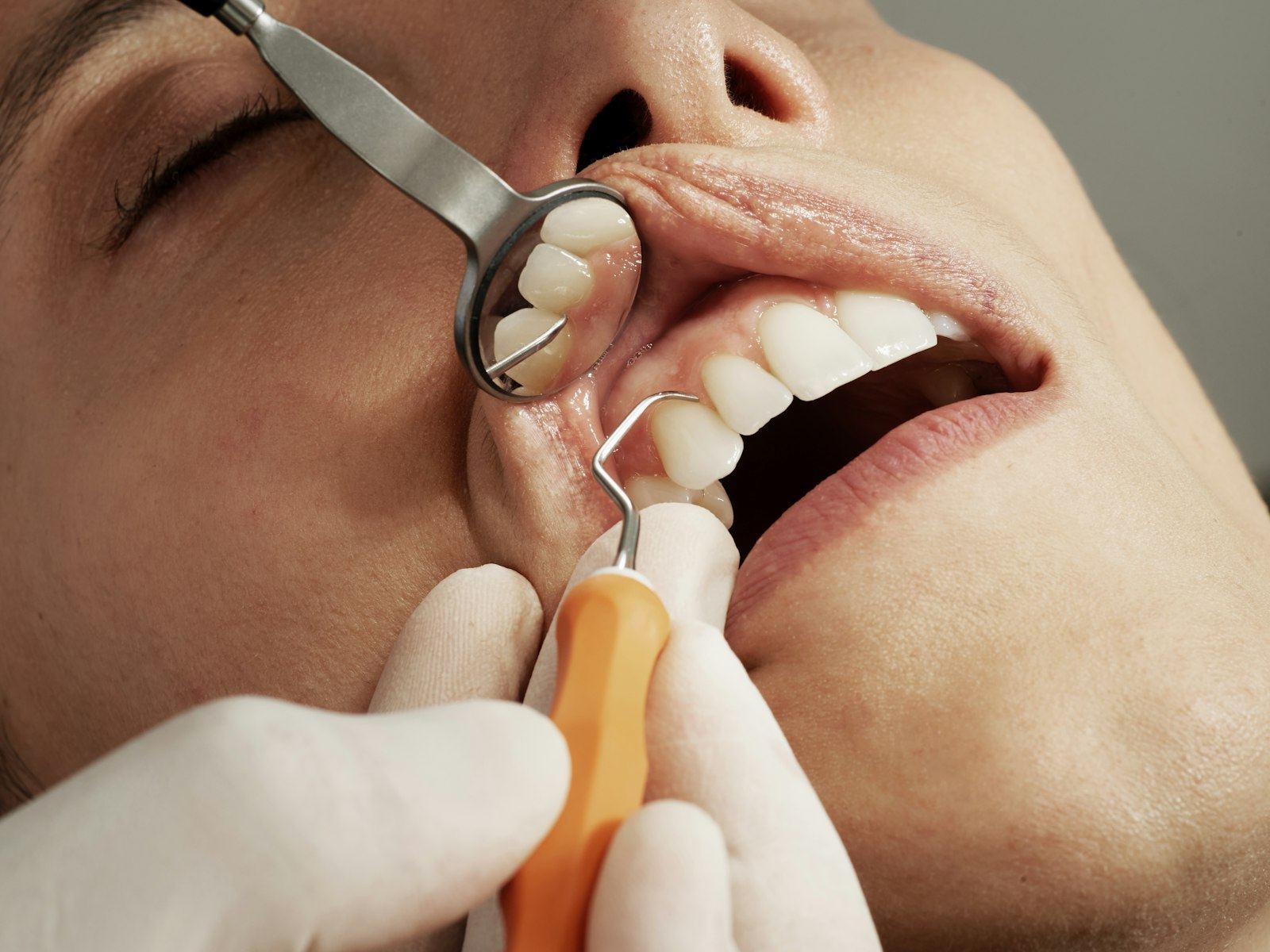 Sonrisa premium Dental Niich